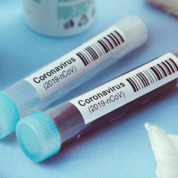 Este Domingo Zafra ha anunciado 16 nuevos casos positivos por coronavirus y ningún alta.